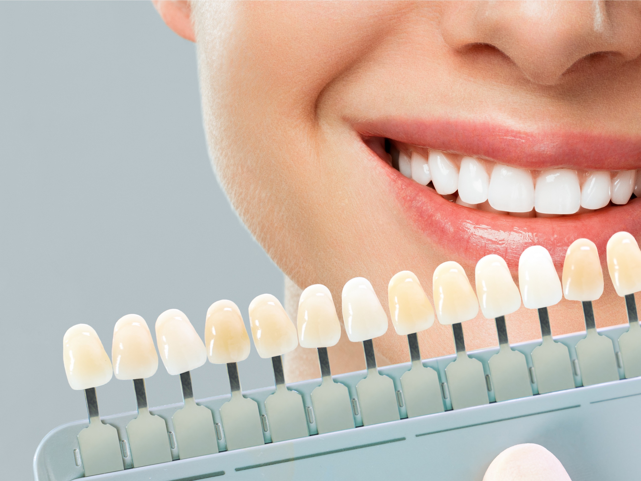 Teeth whitening service in Omaha