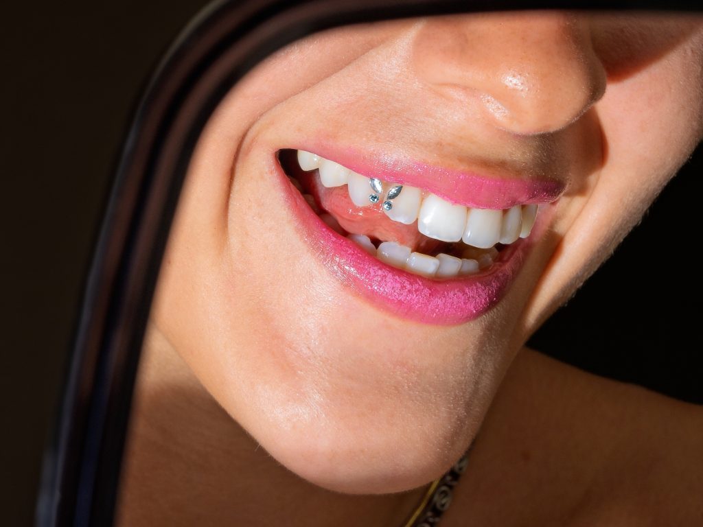 Tooth Gems and Smile Bling service in Omaha